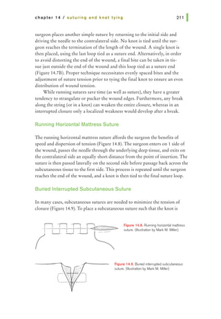 chapter 14 I suturing and knot tying 211 1
surgeon places another simple suture by returning to the initial side and
driving the needle to the contralateral side. No knot is tied until the sur-
geon reaches the termination of the length of the wound. A single knot is
then placed, using the last loop tied as a suture end. Alternatively, in order
to avoid distorting the end of the wound, a final bite can be taken in tis-
sue just outside the end of the wound and this loop tied as a suture end
(Figure 14.7B). Proper technique necessitates evenly spaced bites and the
adjustment of suture tension prior to tying the final knot to ensure an even
distribution of wound tension.
While running sutures save time (as well as suture), they have a greater
tendency to strangulate or pucker the wound edges. Furthermore, any break
along the string (or in a knot) can weaken the entire closure, whereas in an
interrupted closure only a localized weakness would develop after a break.
Running Horizontal Mattress Suture
The running horizontal mattress suture affords the surgeon the benefits of
speed and dispersion of tension (Figure 14.8). The surgeon enters on 1 side of
the wound, passes the needle through the underlying deep tissue, and exits on
the contralateral side an equally short distance from the point of insertion. The
suture is then passed laterally on the second side before passage back across the
subcutaneous tissue to the first side. This process is repeated until the surgeon
reaches the end of the wound, and a knot is then tied to the final suture loop.
Buried Interrupted Subcutaneous Suture
In many cases, subcutaneous sutures are needed to minimize the tension of
closure (Figure 14.9). To place a subcutaneous suture such that the knot is
Figure 14.8. Running horizontal mattress
suture. (Illustration by Mark M. Miller)
Figure 14.9. Buried interrupted subcutaneous
suture. (Illustration by Mark M. Miller)
 