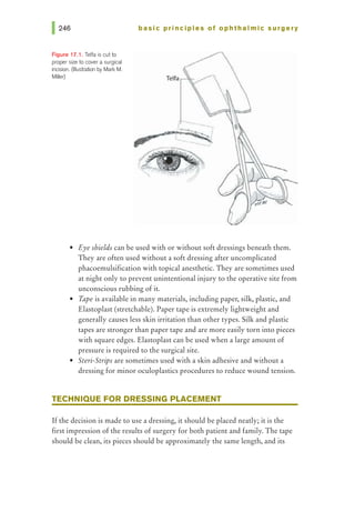 Figure 17.1. Telfa is cut to
proper size to cover a surgical
incision. Ollustration by Mark M.
Miller)
basic pri nci pies of ophthalmic surgery
Telfa ..
• Eye shields can be used with or without soft dressings beneath them.
They are often used without a soft dressing after uncomplicated
phacoemulsification with topical anesthetic. They are sometimes used
at night only to prevent unintentional injury to the operative site from
unconscious rubbing of it.
• Tape is available in many materials, including paper, silk, plastic, and
Elastoplast (stretchable). Paper tape is extremely lightweight and
generally causes less skin irritation than other types. Silk and plastic
tapes are stronger than paper tape and are more easily torn into pieces
with square edges. Elastoplast can be used when a large amount of
pressure is required to the surgical site.
• Steri-Strips are sometimes used with a skin adhesive and without a
dressing for minor oculoplastics procedures to reduce wound tension.
TECHNIQUE FOR DRESSING PLACEMENT
Ifthe decision is made to use a dressing, it should be placed neatly; it is the
first impression of the results of surgery for both patient and family. The tape
should be clean, its pieces should be approximately the same length, and its
 