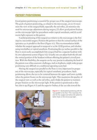 chapter 4 I the operating microscope and surgical loupes 31 I
PATIENT POSITIONING
Good patient positioning is essential for proper use of the surgical microscope.
The goals ofpatient positioning, as related to the microscope, are to (1) maxi-
mize the view of the surgical field, especially the red reflex, (2) minimize the
need for microscope adjustment during surgery, (3) allow good patient fixation
on the microscope light for procedures under topical anesthesia, and (4) avoid
excess light exposure to the patient.
Careful positioning of the surgical eye relative to the microscope is the first
step in a successful surgery. Position the patient so that the corneal surface ofthe
operative eye is parallel to the floor (Figure 4.1). This recommendation holds
whether the surgical approach is temporal or at the 12:00 position, and whether
using retrobulbar or topical anesthesia. Positioning the eye surface parallel to the
floor is most easily accomplished if the surgical bed has a separate headrest with
its own adjustment system (Figure 4.2). Usually one can adjust both the tilt and
the vertical position of the headrest without affecting the patient's overall posi-
tion. With this flexibility, the surgeon can be veryprecise in adjusting the head of
the patient even when anatomic challenges, such as kyphosis, might make proper
positioning very difficult on a traditional operating room bed.
Having the surgical eye parallel to the floor is very important for proper
use of the microscope, especially for topical anesthetic procedures. Such
positioning allows the eye to be centered between the upper and lower eyelids
when the patient fixates on the microscope light. This maximizes the quality of
the surgical view as well as the red reflex, and it helps the patient to maintain
proper fixation on the microscope light. Ifthe patient is positioned so that
her chin is up (Figure 4.3) and the superior limbus of the eye tilts toward the
Figure 4.1. Good patient positioning wilh the
•eye parallel to lhe floor." This maximizes the
view forthe surgeon and allows the patient to
better fixate on the microscope light.
 