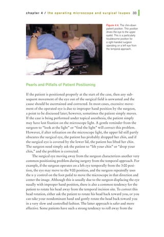 chapter 4 I the operating microscope and surgical loupes 331
Pearls and Pitfalls of Patient Positioning
Figure 4.4. The chin-down
patient position. This position
drives the eye to 1he upper
eyelid. This is a particularly
troublesome position for
a right-handed surgeon
operating on a left eye from
1he temporal approach.
Ifthe patient is positioned properly at the start of the case, then any sub-
sequent movement of the eye out of the surgical field is unwanted and the
cause should be ascertained and corrected. In most cases, excessive move-
ment of the operated eye is due to improper hand position by the surgeon,
a point to be discussed later; however, sometimes the patient simply moves.
Ifthe case is being performed under topical anesthesia, the patient simply
may have lost fixation on the microscope light. A gentle reminder from the
surgeon to "look at the light• or "find the light• will correct this problem.
However, if after refixation on the microscope light, the upper lid still partly
obscures the surgical eye, the patient has probably dropped her chin, and if
the surgical eye is covered by the lower lid, the patient has lifted her chin.
The surgeon need simply ask the patient to "lift your chin" or "drop your
chin," and the problem is corrected.
The surgical eye moving away from the surgeon characterizes another very
common positioning problem during surgery from the temporal approach. For
example, if the surgeon operates on a left eye temporally from the 3:00 posi-
tion, the eye may move to the 9:00 position, and the surgeon repeatedly uses
the x-y control on the foot pedal to move the microscope in that direction and
center the image. Although this is usually due to the surgeon displacing the eye
nasally with improper hand position, there is also a common tendency for the
patient to rotate his head away from the temporal incision site. To correct this
head rotation, either ask the patient to rotate his head back toward you, or you
can take your nondominant hand and gendy rotate the head back toward you
in a very slow and controlled fashion. The latter approach is safer and more
effective. Some patients have such a strong tendency to roll away from the
 