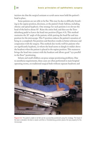 basic prl ncl pies of ophthalmic surgery
incision site that the surgical assistant or scrub nurse must hold the patient,s
head in place.
Some patients are not able to lie flat. This may be due to difficulty breath-
ing in the supine position, dizziness, or the patient's body habitus, including
obesity and spinal kyphosis. One strategy for such patients is to elevate the
head of the bed to about 30°. Raise the entire bed, and then use the Tren-
delenburg pedal to lower the head into position (Figure 4.5). This method
maintains the 30° angle of the patient, while putting the head flat and into
position for the microscope. This V-position reduces the patient,s sensation of
being in a completely flat position and therefore results in better tolerance and
cooperation with the surgery. This method also works well for patients who
are significantly kyphotic, in whom the head seems to dangle in midair above
the headrest when the patient is placed in the supine position. This maneuver
brings the head into contact with the headrest and allows good "eye parallel
to the floor» positioning.
Infants and small children can pose unique positioning problems. Due
to anesthesia requirements, these cases are often performed in main hospital
operating rooms, on traditional surgical beds without separate headrests and
Figure 4.5. The patient unable to lie flat can be successfully positioned using this strategy. The head of
the bed is elevated, 1he bed is raised, and then a Trendelenburg position places the eye properly for 1he
microscope.
 