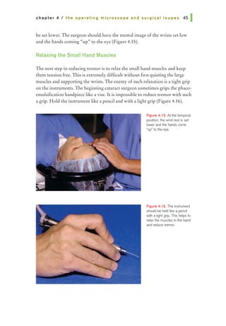 chapter 4 I the operating microscope and surgical loupes 451
be set lower. The surgeon should have the mental image of the wrists set low
and the hands coming "up» to the eye (Figure 4.15).
Relaxing the Small Hand Muscles
The next step in reducing tremor is to relax the small hand muscles and keep
them tension free. This is extremely difficult without first quieting the large
muscles and supporting the wrists. The enemy of such relaxation is a tight grip
on the instruments. The beginning cataract surgeon sometimes grips the phaco-
emulsification handpiece like a vise. It is impossible to reduce tremor with such
a grip. Hold the instrument like a pencil and with a light grip (Figure 4.16).
Figure 4.15. At the temporal
position, the wrist rest is set
lower and the hands come
•up• to the eye.
Figure 4.16. The instrument
should be held like a pencil
with a light grip. This helps to
relax the muscles in the hand
and reduce tremor.
 