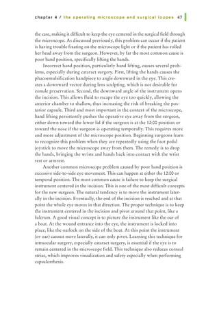chapter 4 I the operating microscope and surgical loupes 47 1
the case, making it difficult to keep the eye centered in the surgical field through
the microscope. As discussed previously, this problem can occur if the patient
is having trouble fixating on the microscope light or if the patient has rolled
her head away from the surgeon. However, by far the most common cause is
poor hand position, specifically lifting the hands.
Incorrect hand position, particularly hand lifting, causes several prob-
lems, especially during cataract surgery. First, lifting the hands causes the
phacoemulsification handpiece to angle downward in the eye. This cre-
ates a downward vector during lens sculpting, which is not desirable for
zonule preservation. Second, the downward angle of the instrument opens
the incision. This allows fluid to escape the eye too quickly, allowing the
anterior chamber to shallow, thus increasing the risk of breaking the pos-
terior capsule. Third and most important in the context of the microscope,
hand lifting persistently pushes the operative eye away from the surgeon,
either down toward the lower lid if the surgeon is at the 12:00 position or
toward the nose if the surgeon is operating temporally. This requires more
and more adjustment of the microscope position. Beginning surgeons learn
to recognize this problem when they are repeatedly using the foot pedal
joystick to move the microscope away from them. The remedy is to drop
the hands, bringing the wrists and hands back into contact with the wrist
rest or armrest.
Another common microscope problem caused by poor hand position is
excessive side-to-side eye movement. This can happen at either the 12:00 or
temporal position. The most common cause is failure to keep the surgical
instrument centered in the incision. This is one of the most difficult concepts
for the new surgeon. The natural tendency is to move the instrument later-
ally in the incision. Eventually, the end of the incision is reached and at that
point the whole eye moves in that direction. The proper technique is to keep
the instrument centered in the incision and pivot around that point, like a
fulcrum. A good visual concept is to picture the instrument like the oar of
a boat. At the wound entrance into the eye, the instrument is locked into
place, like the oarlock on the side of the boat. At this point the instrument
(or oar) cannot move laterally, it can only pivot. Learning this technique for
intraocular surgery, especially cataract surgery, is essential if the eye is to
remain centered in the microscope field. This technique also reduces corneal
striae, which improves visualization and safety especially when performing
capsulorrhexis.
 