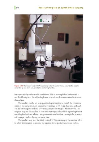 basic prl ncl pies of ophthalmic surgery
Figure 4.19. Microscope head with (A) a centering button to center the x-y axes, (B)1he scale to
center the up and down axis, and (C) the positioning handles.
intraoperatively under sterile conditions. This is accomplished either with a
sterilizable cap over the adjusting knob, or with sterile covers over the oculars
themselves.
The oculars can be set to a specific diopter setting to match the refractive
error of the surgeon; most oculars have a range of +I- 5.00 diopters, and each
can be set independently to accommodate anisometropia. Alternatively, the
surgeon may set the oculars at zero and wear spectacles; this is a good option at
teaching institutions where 2 surgeons may need to view through the primary
microscope oculars during the same case.
The oculars also may be tilted vertically. The main use of the vertical tilt is
to allow the surgeon to assume the upright torso posture discussed earlier.
 
