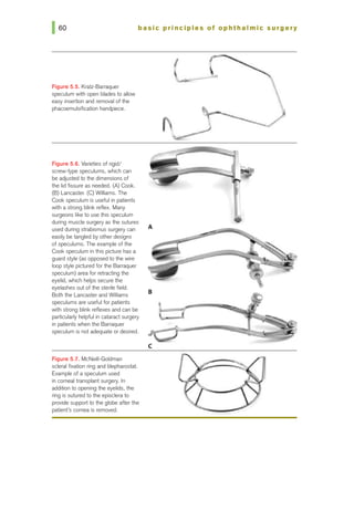 basic principles of ophthalmic surgery
Figure 5.5. Kratz-Barraquer
speculum with open blades to allow
easy insertion and removal of the
phacoemulsification handpiece.
Figure 5.6. Varieties of rigid/
screw-type speculums, which can
be adjusted to the dimensions of
the lid fissure as needed. (A) Cook.
(B) Lancaster. (C) Williams. The
Cook speculum is useful in patients
with a strong blink reflex. Many
surgeons like to use this speculum
during musde surgery as the sutures
used during strabismus surgery can
easily be tangled by other designs
of speculums. The example of the
Cook speculum in this picture has a
guard style (as opposed to the wire
loop style pictured for the Barraquer
speculum) area for retracting the
eyelid, which helps secure the
eyelashes out of the sterile field.
Both the Lancaster and Williams
speculums are useful for patients
with strong blink reflexes and can be
particularty helpful in cataract surgery
in patients when the Barraquer
speculum is not adequate or desired.
Figure 5.7. McNeill-Goldman
scleral fixation ring and blepharostat.
Example of a speculum used
in corneal transplant surgery. In
addition to opening the eyelids, the
ring is sub.Jred to the episclera to
provide support to the globe afterthe
patient's comea is removed.
B
c
 