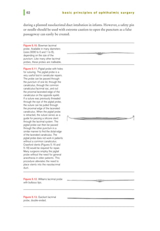 basic prl ncl pies of ophthalmic surgery
during a planned nasolacrimal duct intubation in infants. However, a safety pin
or needle should be used with extreme caution to open the punctum as a false
passageway can easily be created.
Figure 5.10. Bowman laaimal
probe. Available in manydiameters
(sizes 0000 to 0 and 1 to 8),
depending on the size of the
punctum. Like many other lacrimal
probes, these probes are malleable.
Figure 5.11. Pigtail probe with holes
for suturing. The pigtail probe is a
very useful tool in canalicular repairs.
The probe can be passed through
the punctum of one lid, through the
canaliculus, through the common
canaliculus/lacrimal sac, and out
the proximal lacerated edge of the
canaliculus on the opposite eyelid.
If a suture was previouslythreaded
through the eye ofthe pigtail probe,
the suture can be pulled through
the proximal edge of the lacerated
canaliculus. When the pigtail probe
is retracted, the suture serves as a
guide for passing a silicone stent
through the lacrimal system. The
pigtail probe can then be passed
through the other punctum in a
similar mannerto find the distal edge
of the lacerated canaliculus. The
pigtail probe does notworl< in patients
without a common canaliculus;
Crawford stents (Figures 5.16 and
5.18) would be required for repair.
Many surgeons employthe pigtail
probe without the need for general
anesthesia in older patients. This
procedure alleviates the need to
place stents into the nasolacrimal
duct.
Figure 5.12. Williams lacrimal probe
with bulbous tips.
Figure 5.13. Ouickert laaimal
probe, double-ended.
 