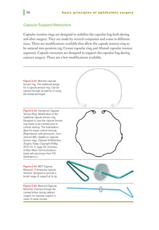 basic principles of ophthalmic surgery
Capsule Support/Retractors
Capsular tension rings are designed to stabilize the capsular bag both during
and after surgery. They are made by several companies and come in different
sizes. There are modifications available that allow the capsule tension ring to
be sutured into position (eg, Cionni capsular ring and Ahmed capsular tension
segment). Capsule retractors are designed to support the capsular bag during
cataract surgery. There are a few modifications available.
Figure 5.42. Morcher capsular
tension ring. The traditional design
for a capsule tension ling. Can be
injected through an injector or using
the fishtail technique.
Figure 5.43. Henderson Capsule
Tension Ring. Modification of the
traditional capsule tension ring.
Designed in case the capsule tension
ring needs to be inserted prior to
cortical cleanup. The indentations
allow for easier cortical removal.
(Reproduced, with permission, from
Jackson MA, Update on capsular
tension rings. Cataract & Refractive
Surgery Today. Copyright C May
2010;10, 6, page 44. Courtesy
of Bryn Mawr Communications.
Used with permission from FCI
OphthaJmics.)
Figure 5.44. MST Capsule
Retractor. A temporary capsule
retractor designed to provide a
broad range of support at its tip.
Figure 5.45. Mackool Capsular
Retractor. Inserted through the
comea!limbus during cataract
surgery for capsular support in
cases of weak zonules.
-------
 