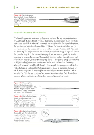 basic principles of ophthalmic surgery
Figure 5.82. Lacrimal cannula.
Used to irrigate through the lacrimal
system. Available in various gauges
and styles of opening. This example
is 23-gauge cannula with a front
opening.
Nucleus Choppers and Splitters
Nucleus choppers are designed to fragment the lens during nucleus disassem-
bly. Although there is broad overlap, there are 2 main styles of choppers: hori-
zontal and vertical. Horizontal choppers are placed under the capsule between
the nucleus and an epinuclear cushion. Utilizing the phacoemulsification tip
for stabilization, the horizontal chopper is then brought "horizontally"' toward
the phaco tip for fragmentation. In contrast, the vertical chopper is placed under
the capsular bag after the nucleus is engaged and vacuum is applied with the
phaco tip to secure the nucleus. The vertical chopper is then directed posteriorly
to crack the nucleus, similar to chopping wood. The "quick"' chop (also known
as diagonal chop) combines elements of horizontal and vertical chopping.
Many choppers are double-sided with a horizontal chopper on one side and a
vertical chopper on the other. Choppers can be made to suit right-handed or
left-handed surgeons. Nucleus splitters are designed to crack the lens. When
learning the "divide and conquer.. technique, surgeons often find that using a
nucleus splitter facilitates cracking after a central groove is created.
Figure 5.63. Standard phaco
chopper. Nucleus choppers are
available in several angles (45°, 60°,
90°) and designs. Used in phaco-
chop cataract surgeryto breakthe
lens nudeus into small pieces.
Figure 5.84. Chang-Seibel chopper.
Double-armed dhopperwith the
Chang MicroFinger on one end and
1he Seibel vertical safety dhopper on
the other end. Styles are available
for use in the right orthe left hand.
Figure 5.65. Akahoshi prechopper.
Designed to split the nucleus without
sculpting. When the forcep handles
are closed, the tips of the forceps
open to split the lens after it is
placed inside the nucleus.
e
 