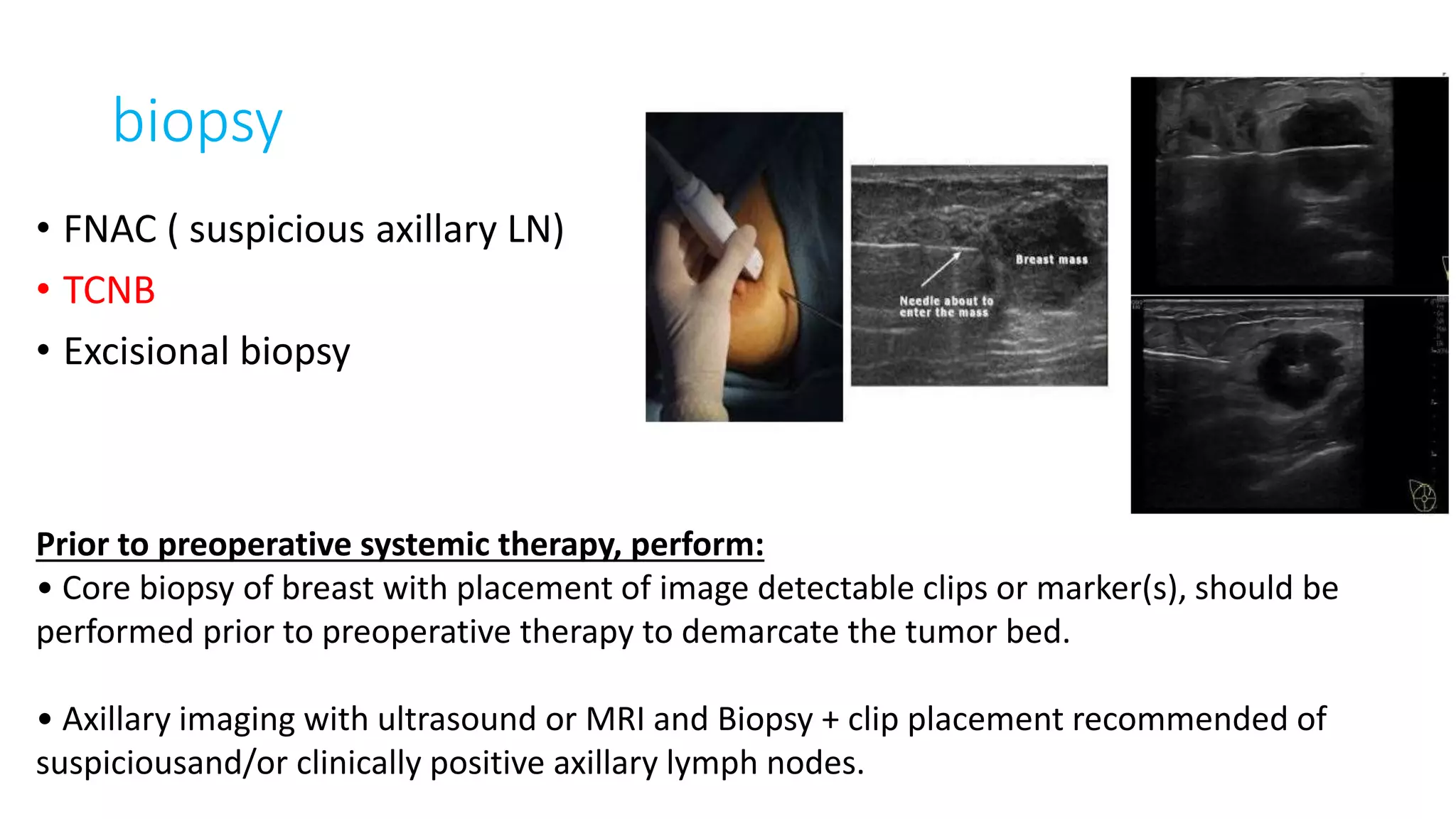 Axillary Clips Basic principles of preoperative therapy in breast cancer.pptx