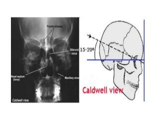 Basic principles of Radiological anatomy.pptx pptx.pptx
