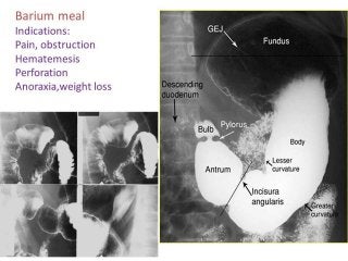 Basic principles of Radiological anatomy.pptx pptx.pptx