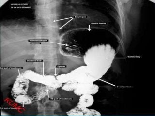 Basic principles of Radiological anatomy.pptx pptx.pptx