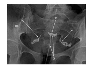 Basic principles of Radiological anatomy.pptx pptx.pptx
