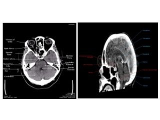 Basic principles of Radiological anatomy.pptx pptx.pptx