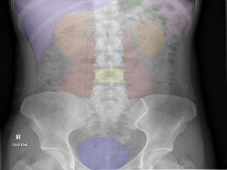 Basic principles of Radiological anatomy.pptx pptx.pptx