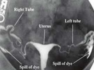 Basic principles of Radiological anatomy.pptx pptx.pptx