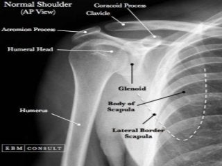 Basic principles of Radiological anatomy.pptx pptx.pptx