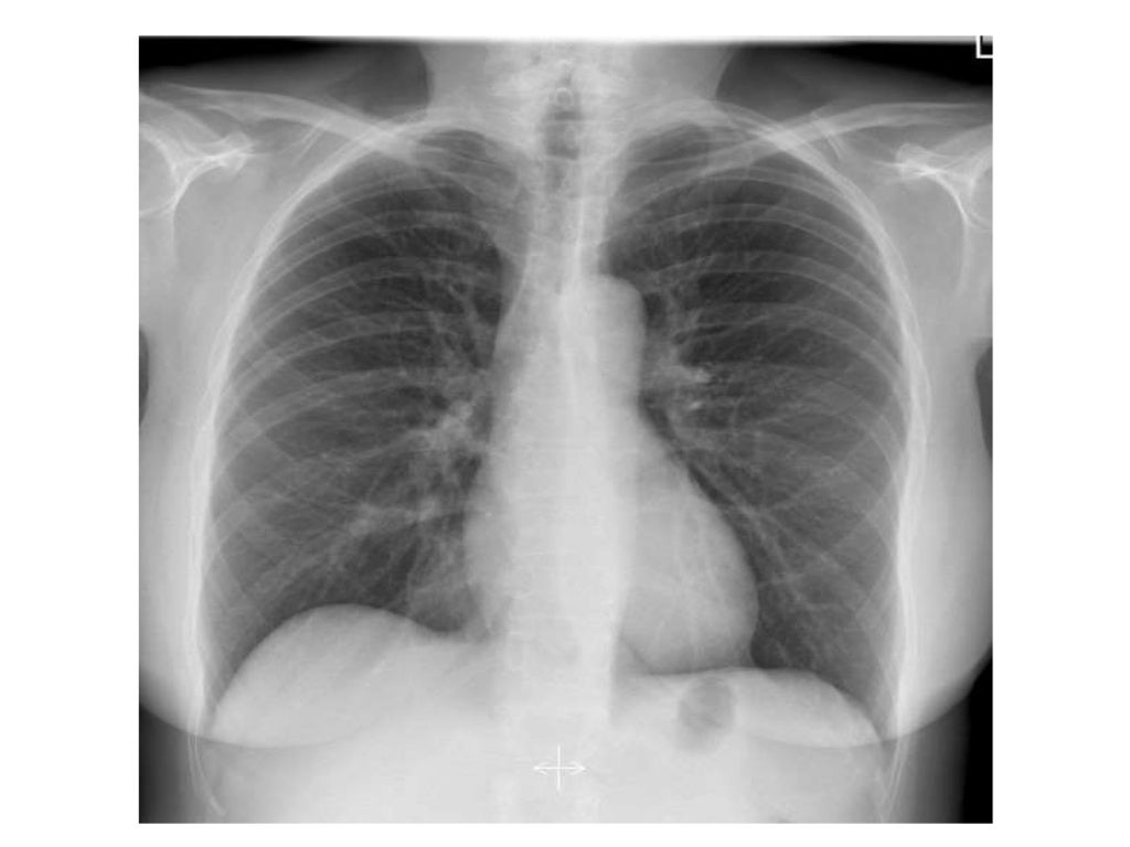Basic principles of Radiological anatomy.pptx pptx.pptx