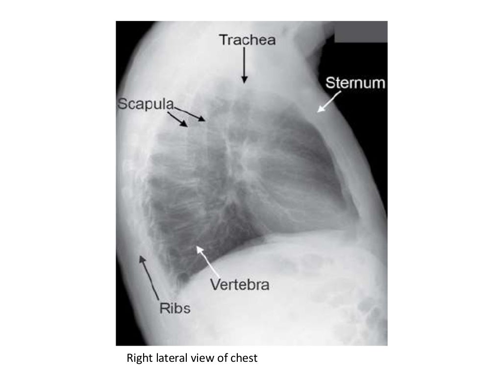 Basic principles of Radiological anatomy.pptx pptx.pptx