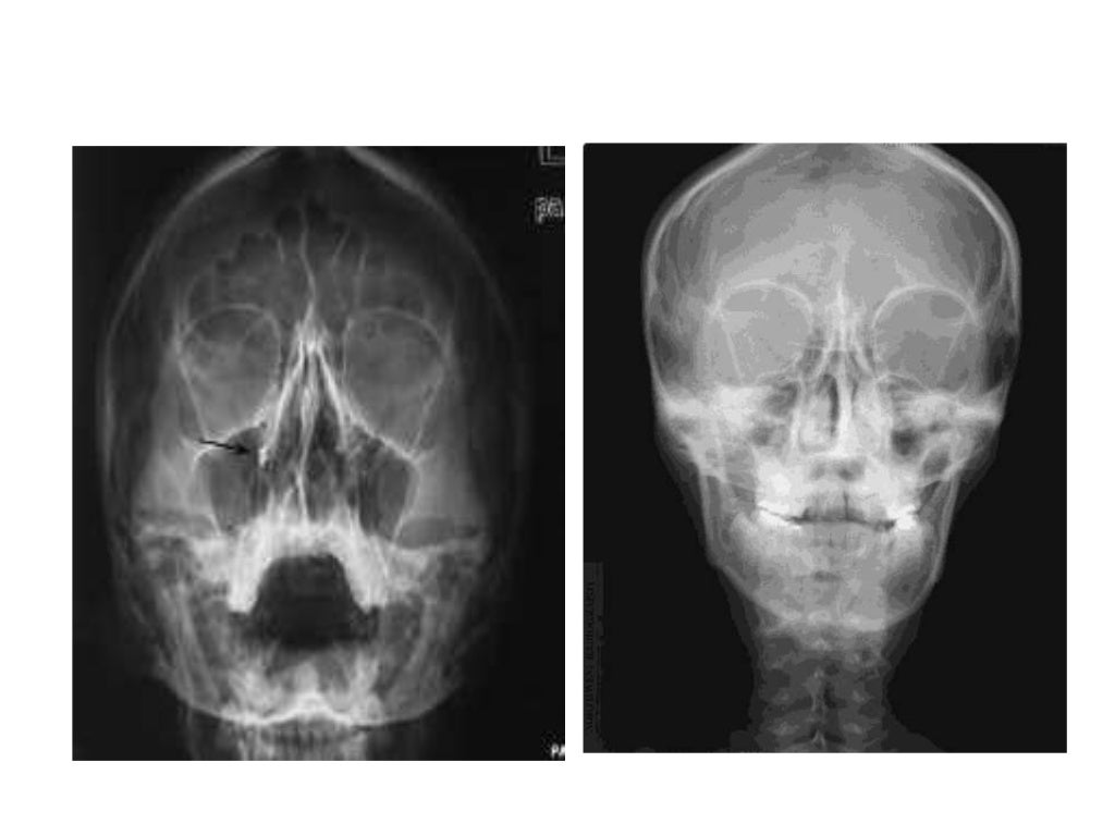 Basic principles of Radiological anatomy.pptx pptx.pptx