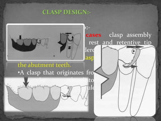 Basic principles of removable partial denture design copy | PPTX