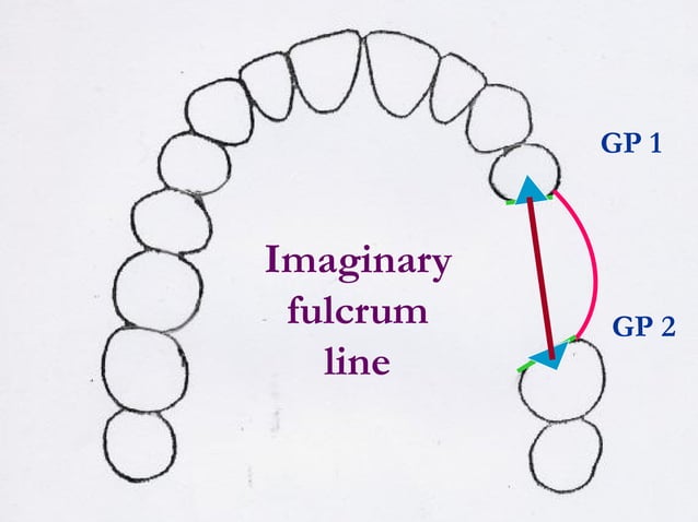 basic_principles_of_removable_partial_denture_design_-_copy.ppt
