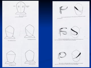 Denture Design Form basic_principles_of_removable_partial_denture_design_-_copy.ppt