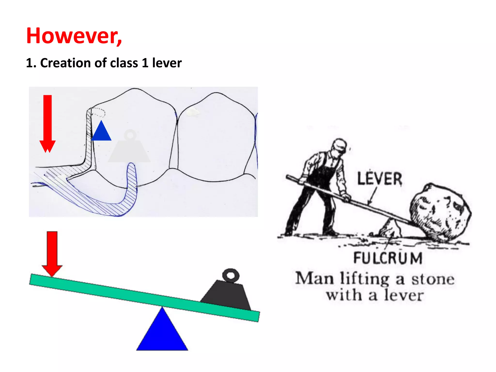 However,
1. Creation of class 1 lever
 