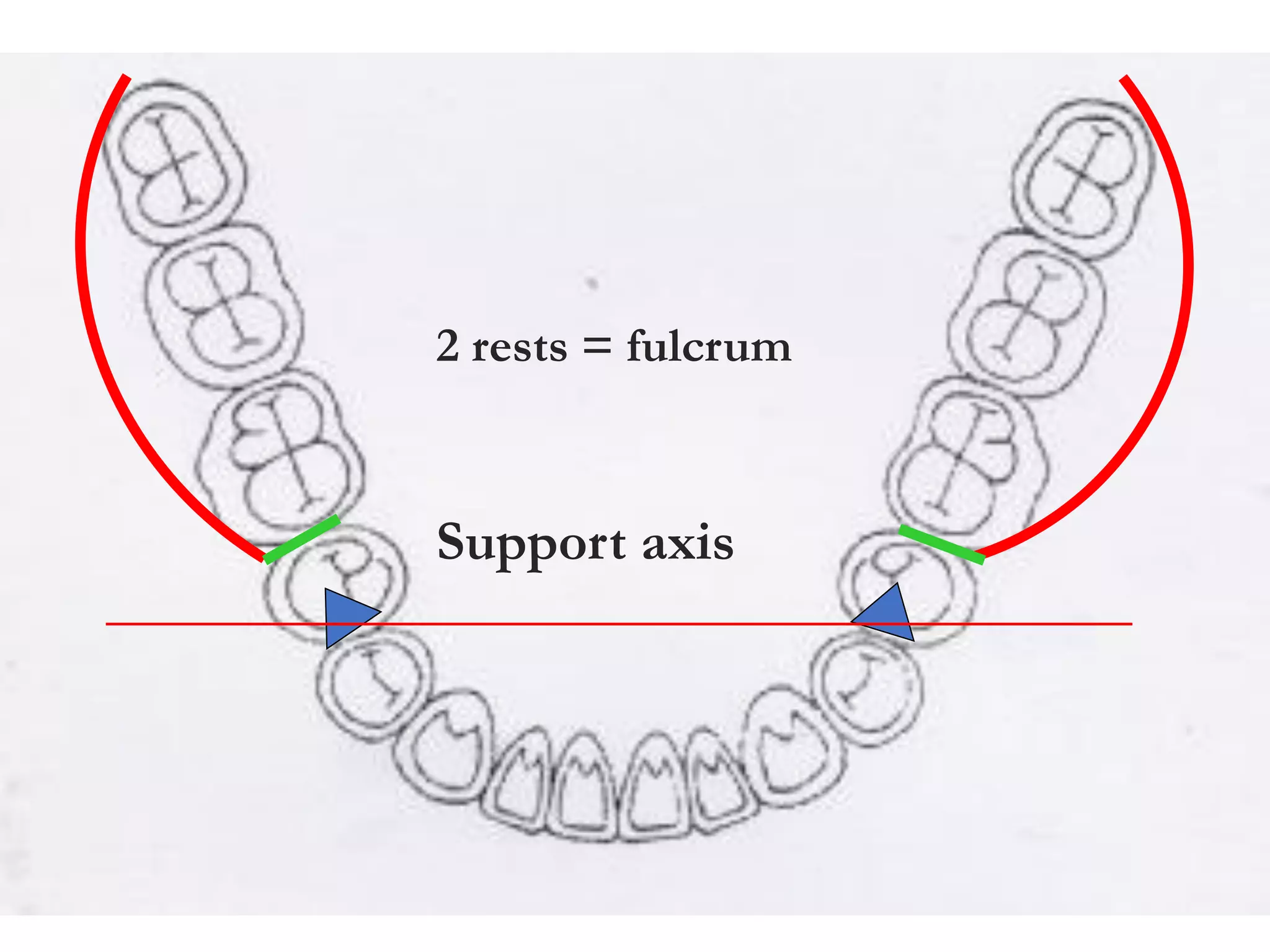 Support axis
2 rests = fulcrum
 