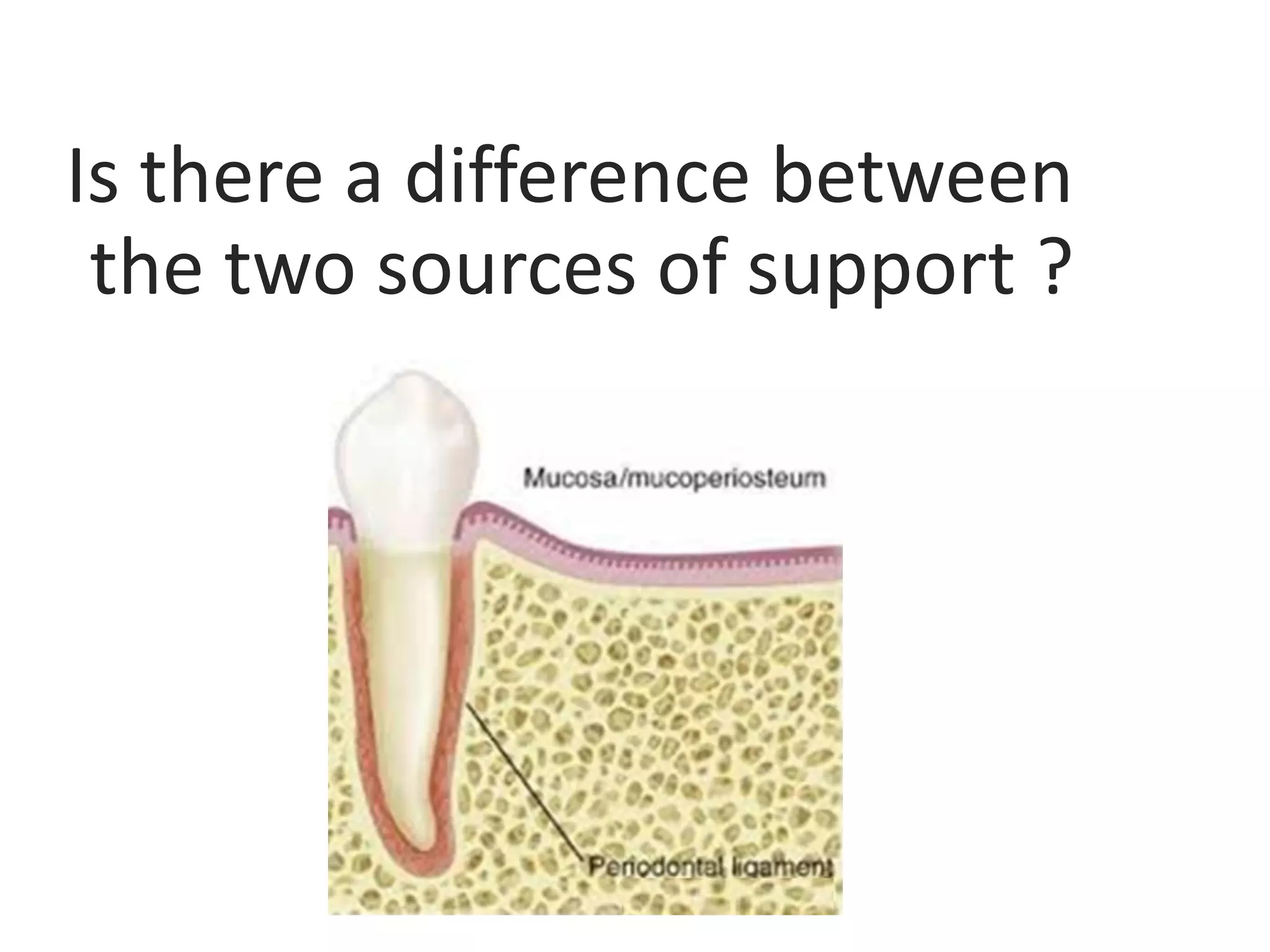Is there a difference between
the two sources of support ?
 