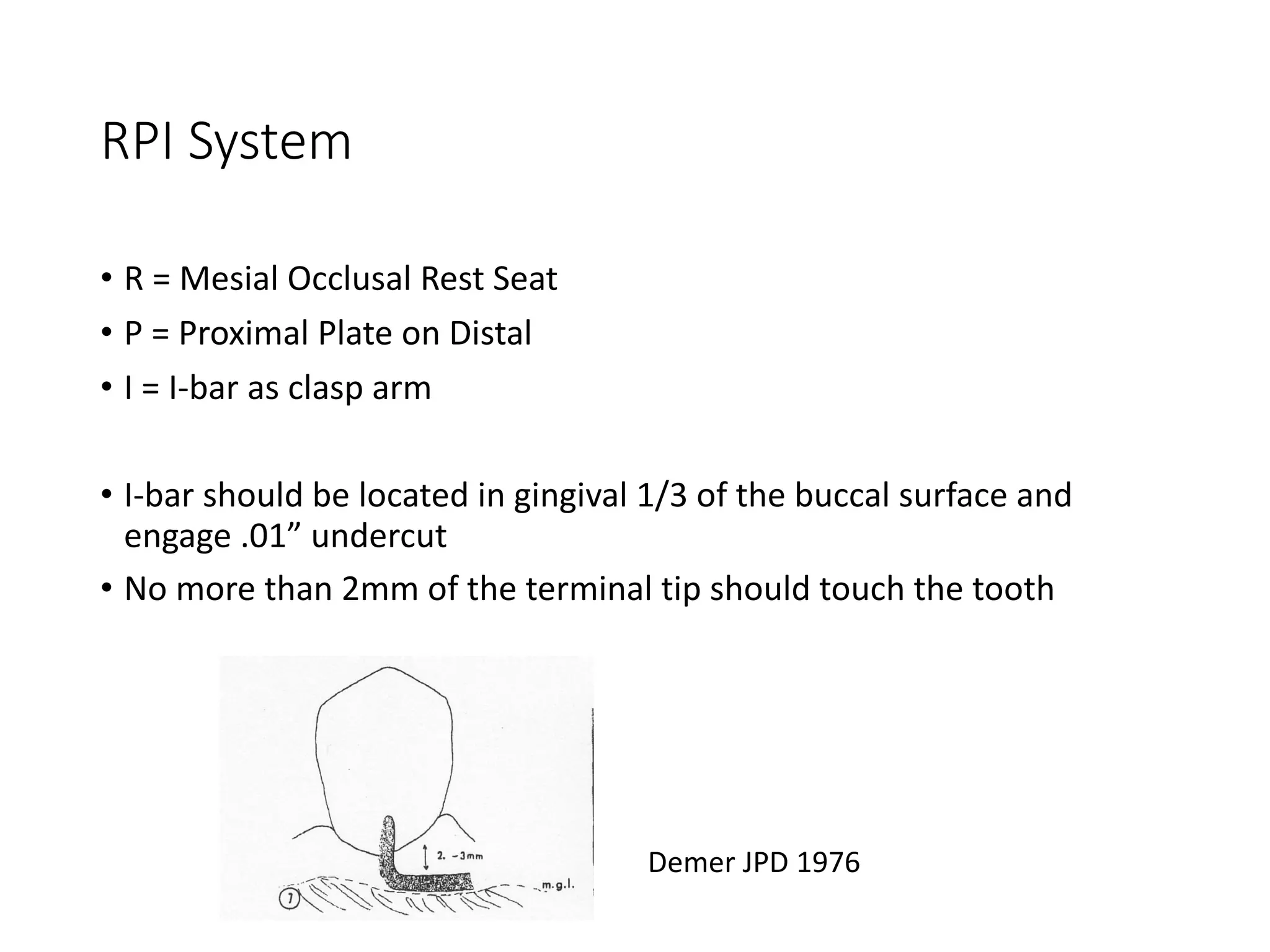 RPI System
• R = Mesial Occlusal Rest Seat
• P = Proximal Plate on Distal
• I = I-bar as clasp arm
• I-bar should be located in gingival 1/3 of the buccal surface and
engage .01” undercut
• No more than 2mm of the terminal tip should touch the tooth
Demer JPD 1976
 