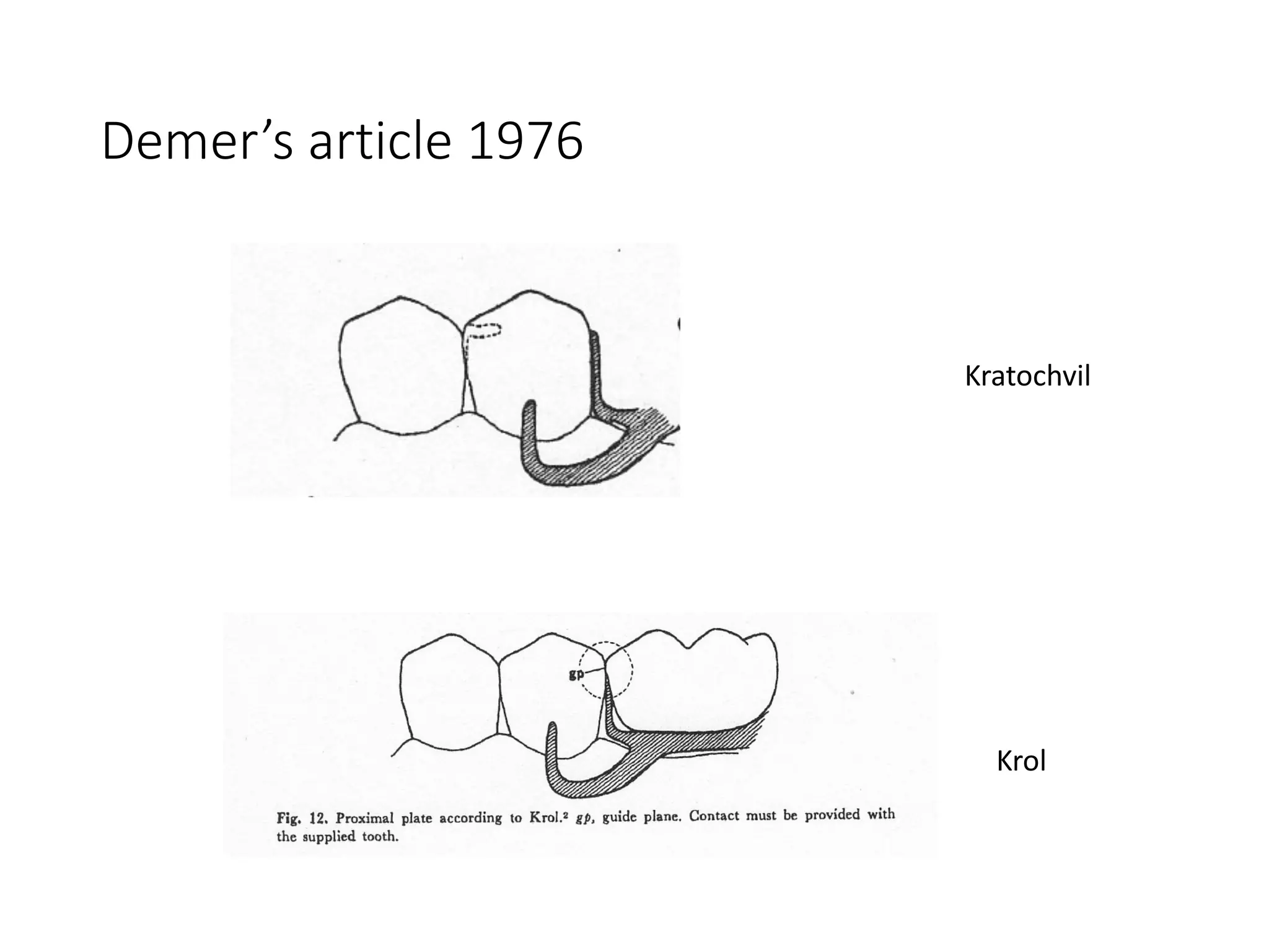 Demer’s article 1976
Kratochvil
Krol
 