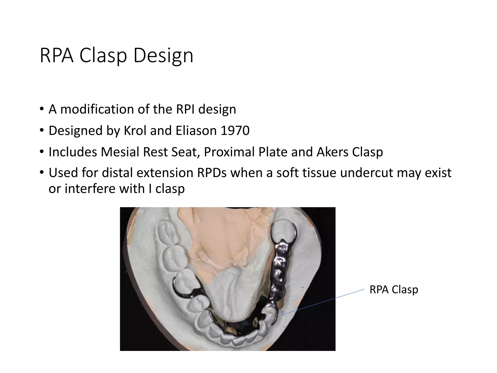 RPA Clasp Design
• A modification of the RPI design
• Designed by Krol and Eliason 1970
• Includes Mesial Rest Seat, Proximal Plate and Akers Clasp
• Used for distal extension RPDs when a soft tissue undercut may exist
or interfere with I clasp
RPA Clasp
 