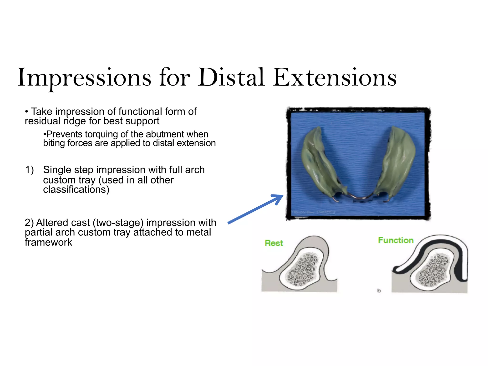 Impressions for Distal Extensions
• Take impression of functional form of
residual ridge for best support
•Prevents torquing of the abutment when
biting forces are applied to distal extension
1) Single step impression with full arch
custom tray (used in all other
classifications)
2) Altered cast (two-stage) impression with
partial arch custom tray attached to metal
framework
 
