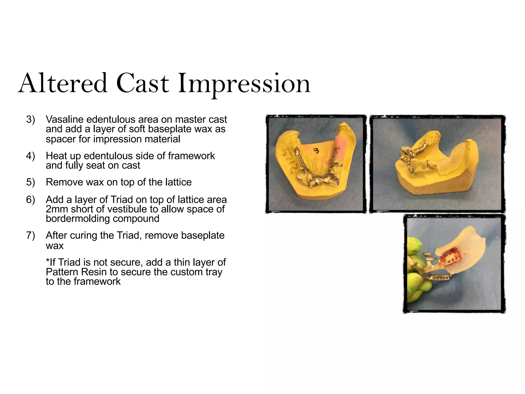 Altered Cast Impression
3) Vasaline edentulous area on master cast
and add a layer of soft baseplate wax as
spacer for impression material
4) Heat up edentulous side of framework
and fully seat on cast
5) Remove wax on top of the lattice
6) Add a layer of Triad on top of lattice area
2mm short of vestibule to allow space of
bordermolding compound
7) After curing the Triad, remove baseplate
wax
*If Triad is not secure, add a thin layer of
Pattern Resin to secure the custom tray
to the framework
 
