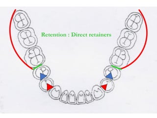 Basic Principles of RPD design I & II.pdf