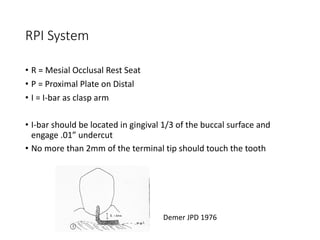 Mesial Rest Rpd Basic Principles of RPD design I & II.pdf