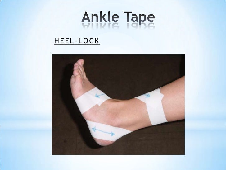 Basic principles of taping techniques Mr. Marc Lievens