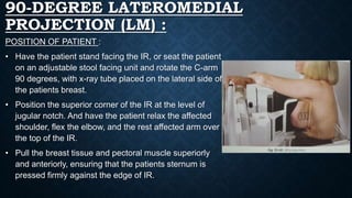 90-DEGREE LATEROMEDIAL
PROJECTION (LM) :
POSITION OF PATIENT :
• Have the patient stand facing the IR, or seat the patient
on an adjustable stool facing unit and rotate the C-arm
90 degrees, with x-ray tube placed on the lateral side of
the patients breast.
• Position the superior corner of the IR at the level of
jugular notch. And have the patient relax the affected
shoulder, flex the elbow, and the rest affected arm over
the top of the IR.
• Pull the breast tissue and pectoral muscle superiorly
and anteriorly, ensuring that the patients sternum is
pressed firmly against the edge of IR.
 
