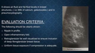 It shows air-fluid and fat-fluid levels in breast
structures. ( i.e; Milk of calcium, galactoceles ) and in
pneumocystography.
EVALUATION CRITERIA :
The following should be clearly shown :
o Nipple in profile.
o Open inframammary fold.
o Retroglandular fat well visualized to ensure inclusion
of deep fibroglandular breast tissue.
o Uniform tissue exposure if compression is adequate.
 