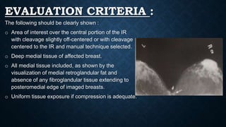 EVALUATION CRITERIA :
The following should be clearly shown :
o Area of interest over the central portion of the IR
with cleavage slightly off-centered or with cleavage
centered to the IR and manual technique selected.
o Deep medial tissue of affected breast.
o All medial tissue included, as shown by the
visualization of medial retroglandular fat and
absence of any fibroglandular tissue extending to
posteromedial edge of imaged breasts.
o Uniform tissue exposure if compression is adequate.
 
