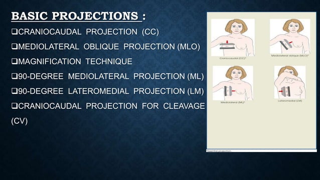 Basic projections of mammogram | PPTX | Medical Tests | Medical Health