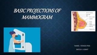 BASICPROJECTIONS OF
MAMMOGRAM
NAME : VENISA PAIS
BATCH : II BMIT
 