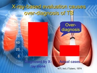 0
20
40
60
80
100
Diagnosed by X-
ray alone
Actual cases
X-ray-based evaluation causesX-ray-based evaluation causes
over-diagnosis of TBover-diagnosis of TB
NTI, Ind J Tuberc, 1974
Over-
diagnosis
 