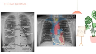 Loopografi Normal Radiologi Basic Radiologi oleh dr. Rika Mutia Hapsari.pptx