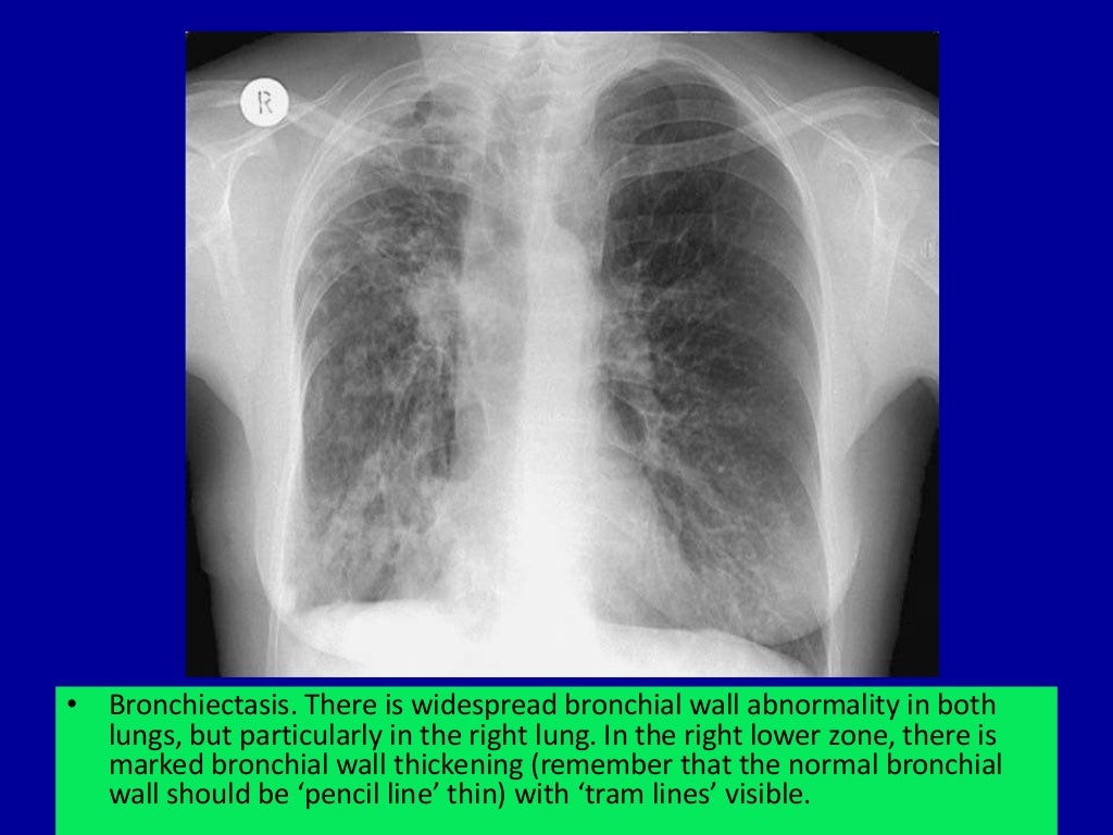Basic radiology for non radiologist