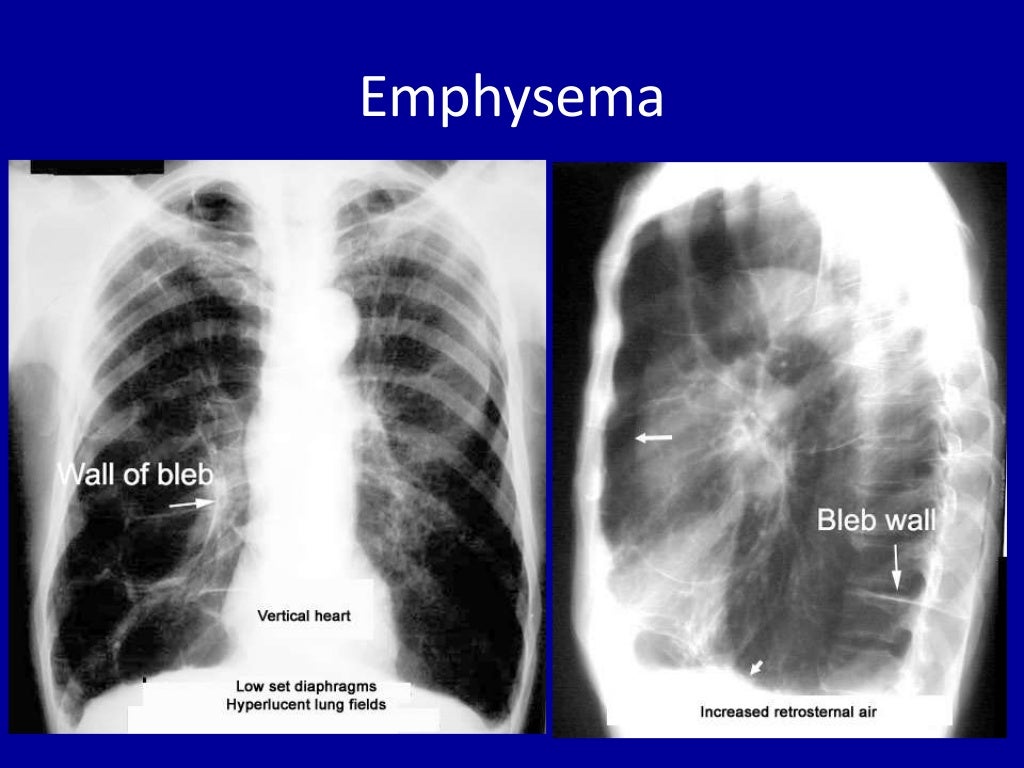 Basic radiology for non radiologist