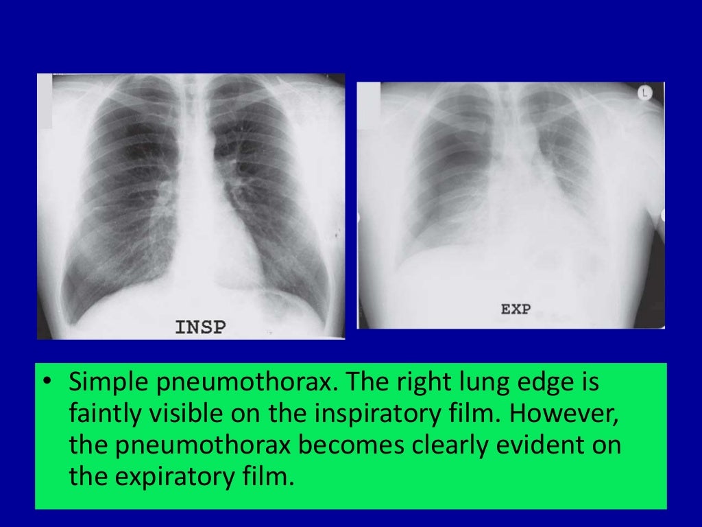Basic radiology for non radiologist