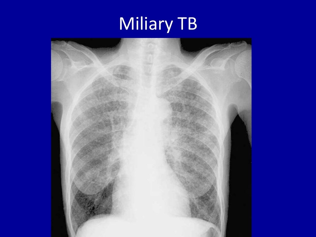 Basic radiology for non radiologist