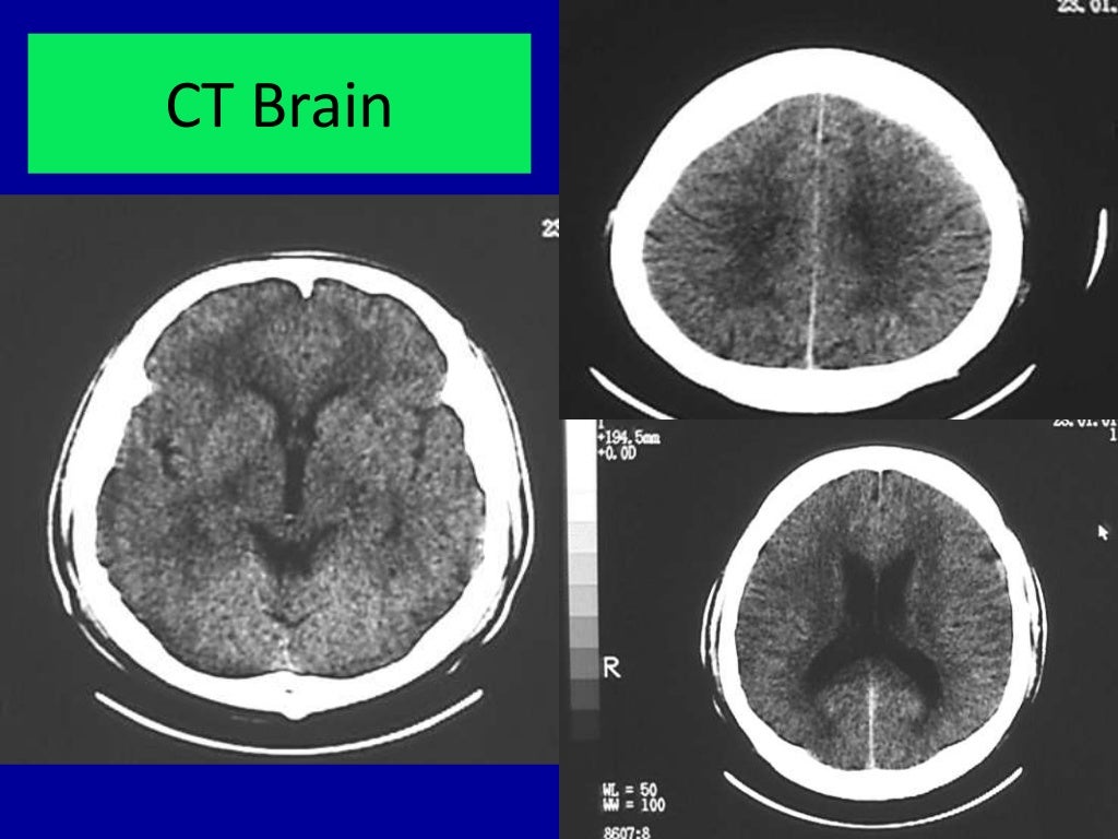 Basic radiology for non radiologist